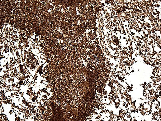 SNCA Antibody in Immunohistochemistry (Paraffin) (IHC (P))