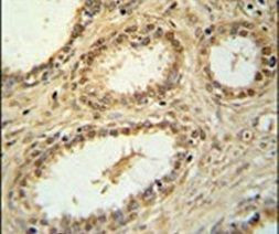 SNRNP40 Antibody in Immunohistochemistry (IHC)