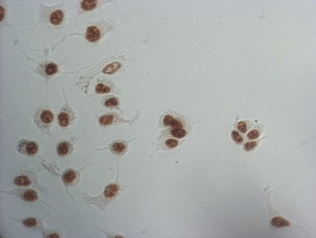 SNRPB2 Antibody in Immunocytochemistry (ICC/IF)