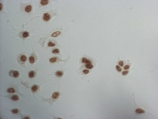 SNRPB2 Antibody in Immunocytochemistry (ICC/IF)