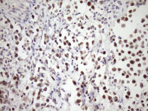 SNRPB2 Antibody in Immunohistochemistry (Paraffin) (IHC (P))