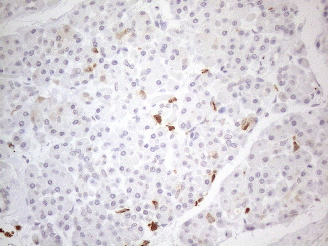 SNRPB2 Antibody in Immunohistochemistry (Paraffin) (IHC (P))