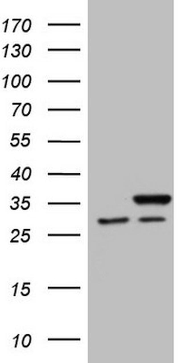 SNRPB2 Antibody in Western Blot (WB)