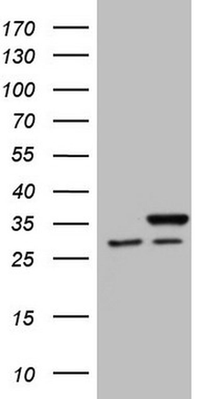 SNRPB2 Antibody in Western Blot (WB)