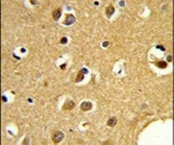 SNRPC Antibody in Immunohistochemistry (IHC)