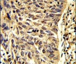 SNRPD1 Antibody in Immunohistochemistry (IHC)