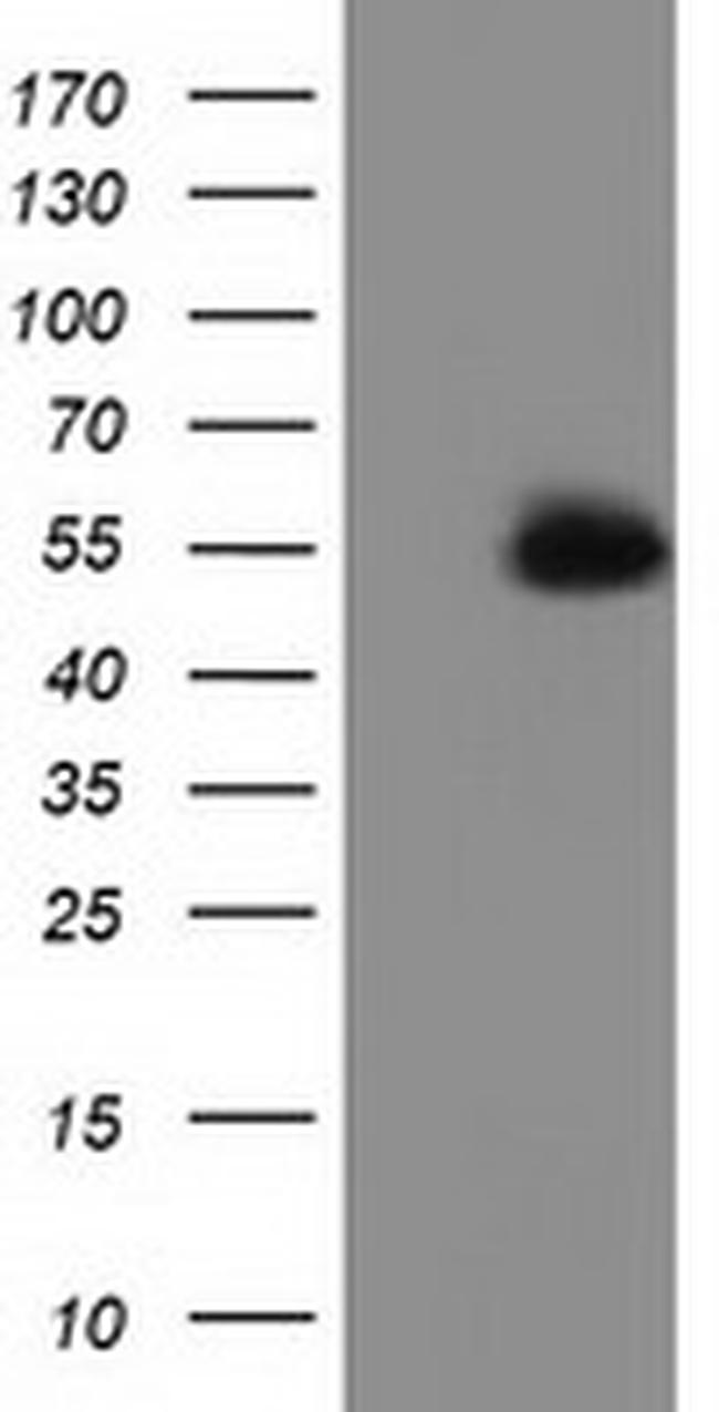 SNTA1 Antibody in Western Blot (WB)