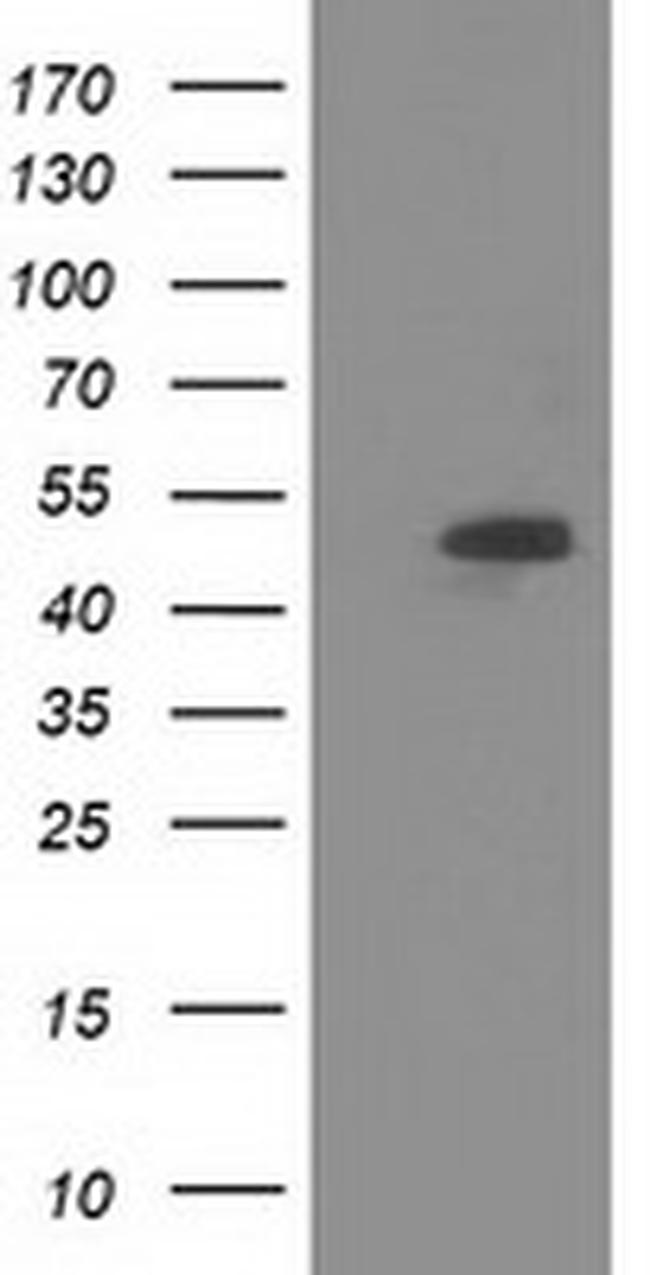 SNTA1 Antibody in Western Blot (WB)