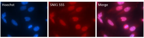 SNX1 Antibody in Immunocytochemistry (ICC/IF)