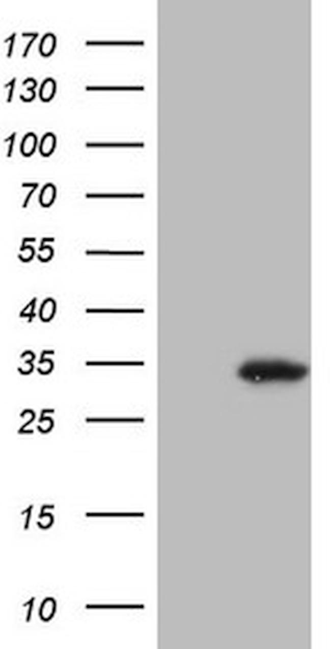 SNX10 Antibody in Western Blot (WB)