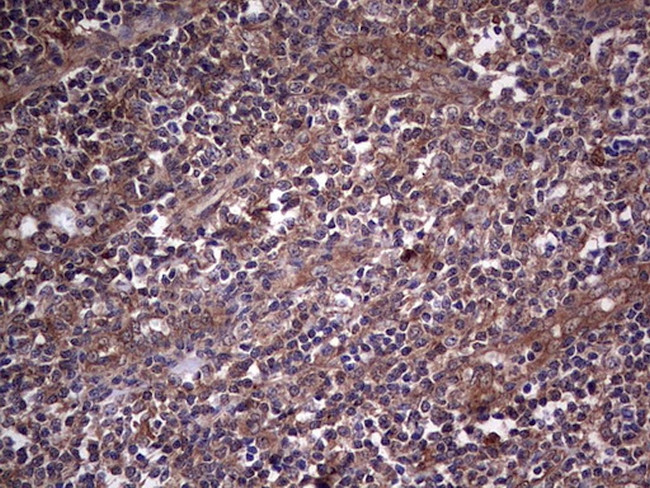 SNX12 Antibody in Immunohistochemistry (Paraffin) (IHC (P))