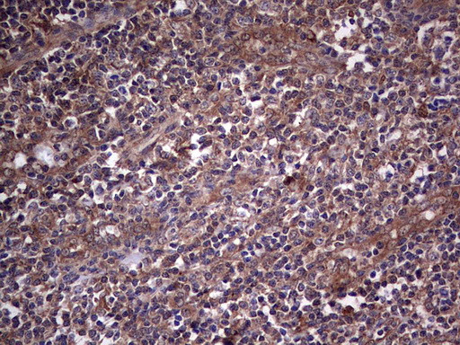 SNX12 Antibody in Immunohistochemistry (Paraffin) (IHC (P))