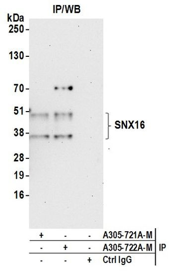 SNX16 Antibody in Immunoprecipitation (IP)