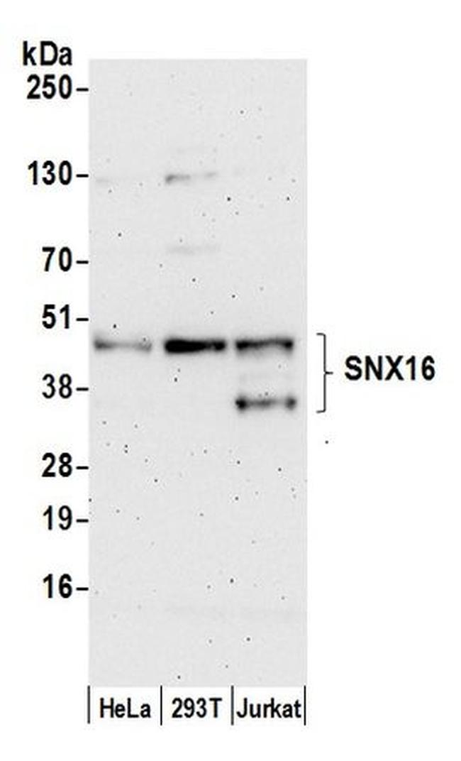 SNX16 Antibody in Western Blot (WB)