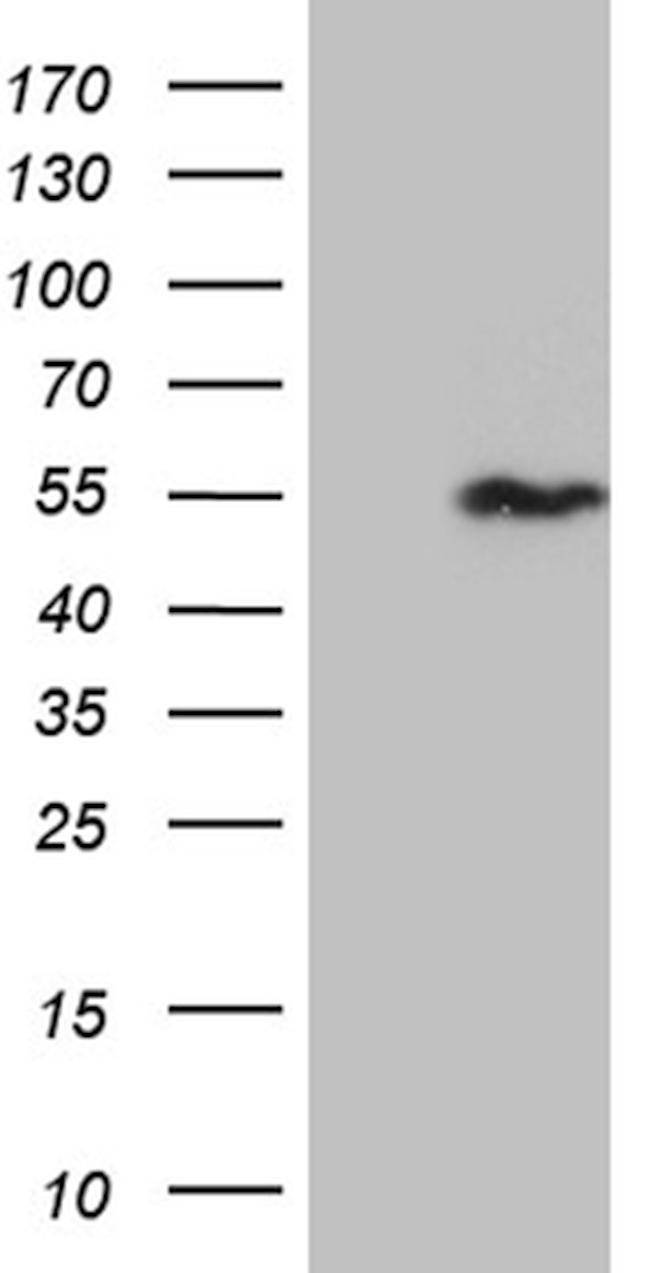SNX4 Antibody in Western Blot (WB)
