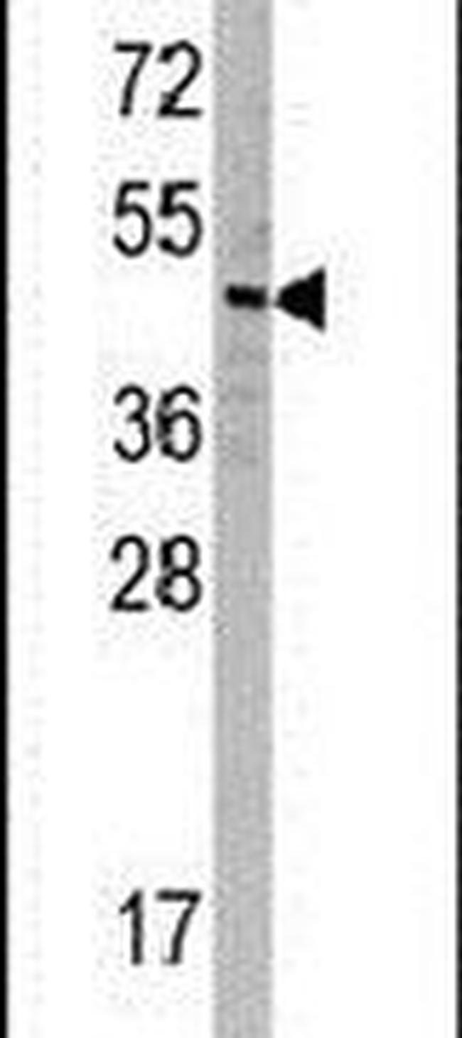 SNX6 Antibody in Western Blot (WB)