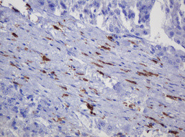 SOAT2 Antibody in Immunohistochemistry (Paraffin) (IHC (P))