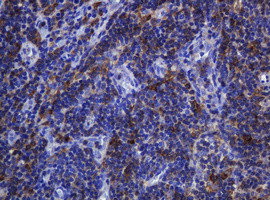 SOAT2 Antibody in Immunohistochemistry (Paraffin) (IHC (P))