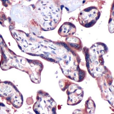 SOCS3 Antibody in Immunohistochemistry (IHC)