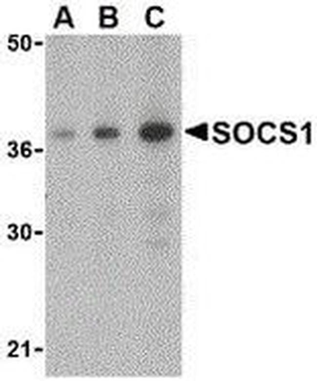 SOCS1 Antibody in Western Blot (WB)
