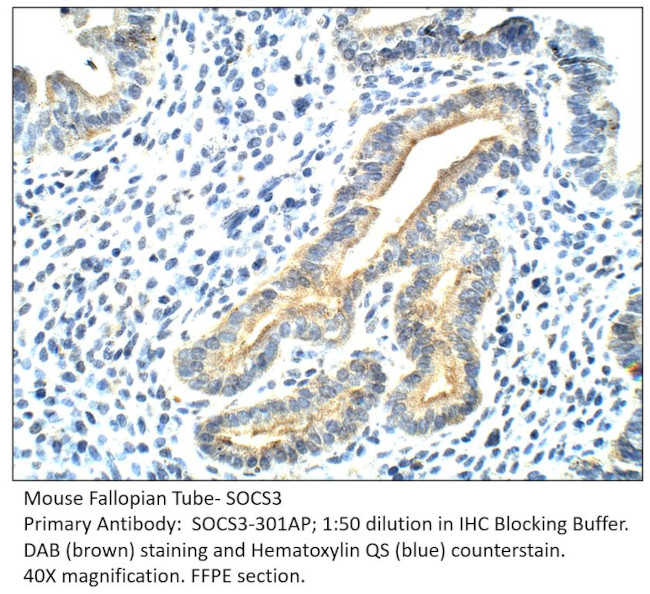 SOCS3 Antibody in Immunohistochemistry (IHC)