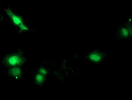 SOCS3 Antibody in Immunocytochemistry (ICC/IF)
