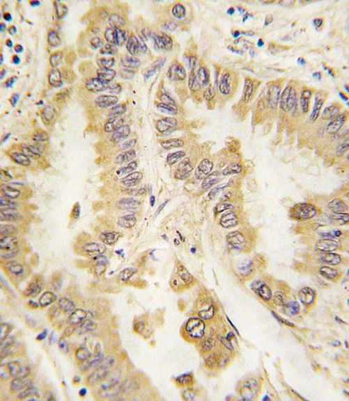 SOD2 Antibody in Immunohistochemistry (IHC)