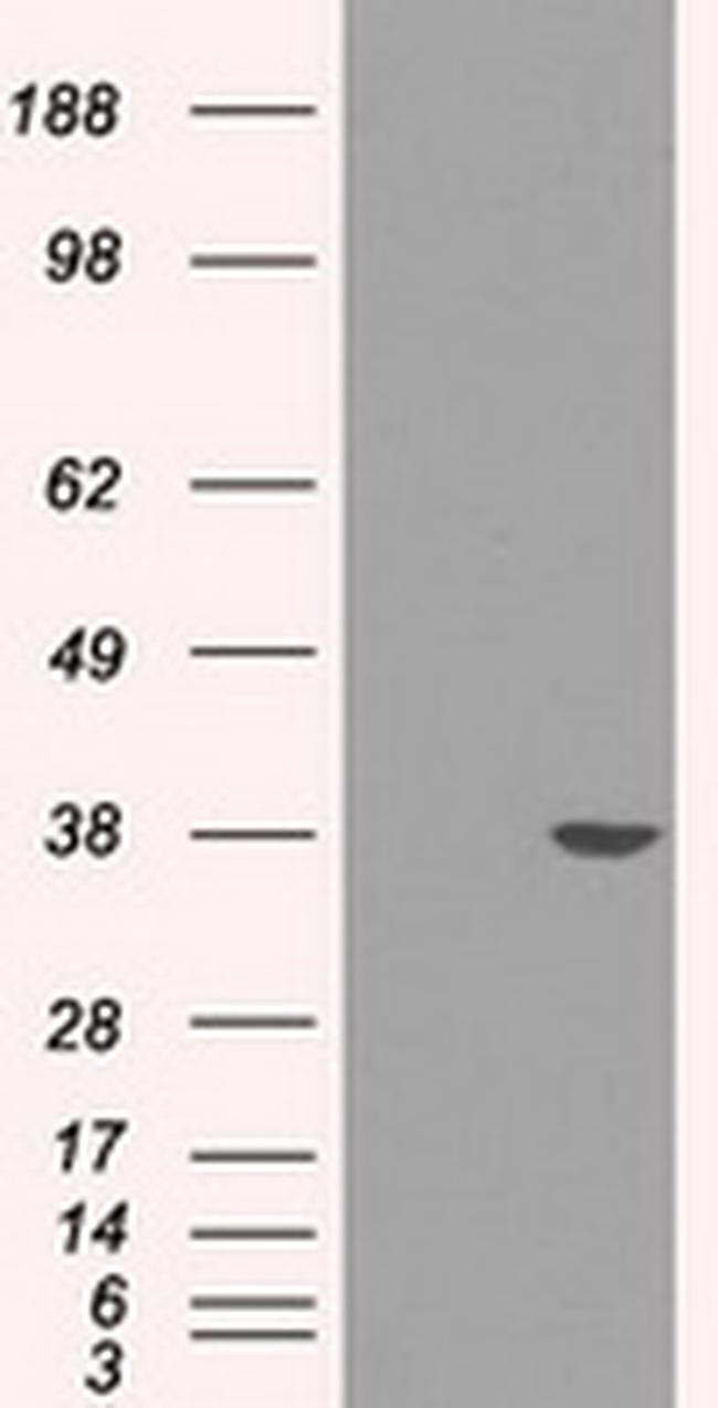 SORD Antibody in Western Blot (WB)