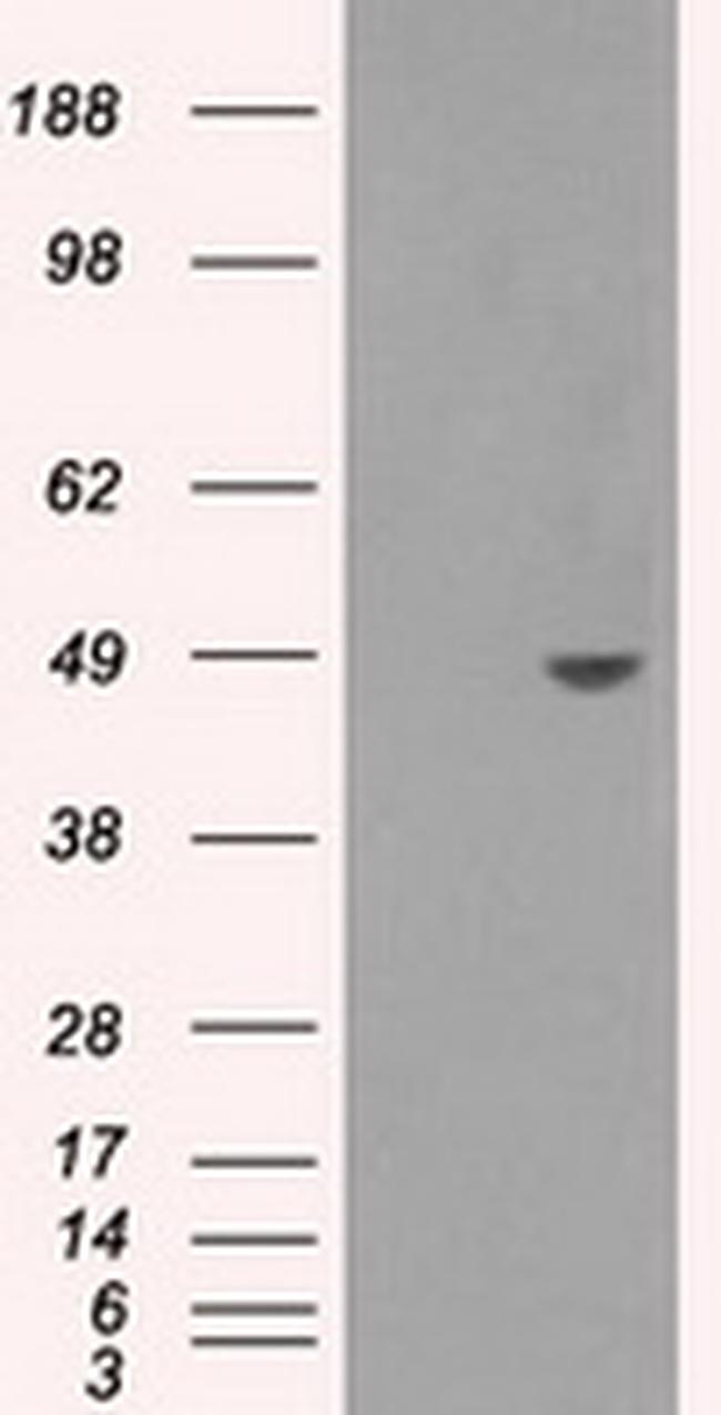 SORD Antibody in Western Blot (WB)