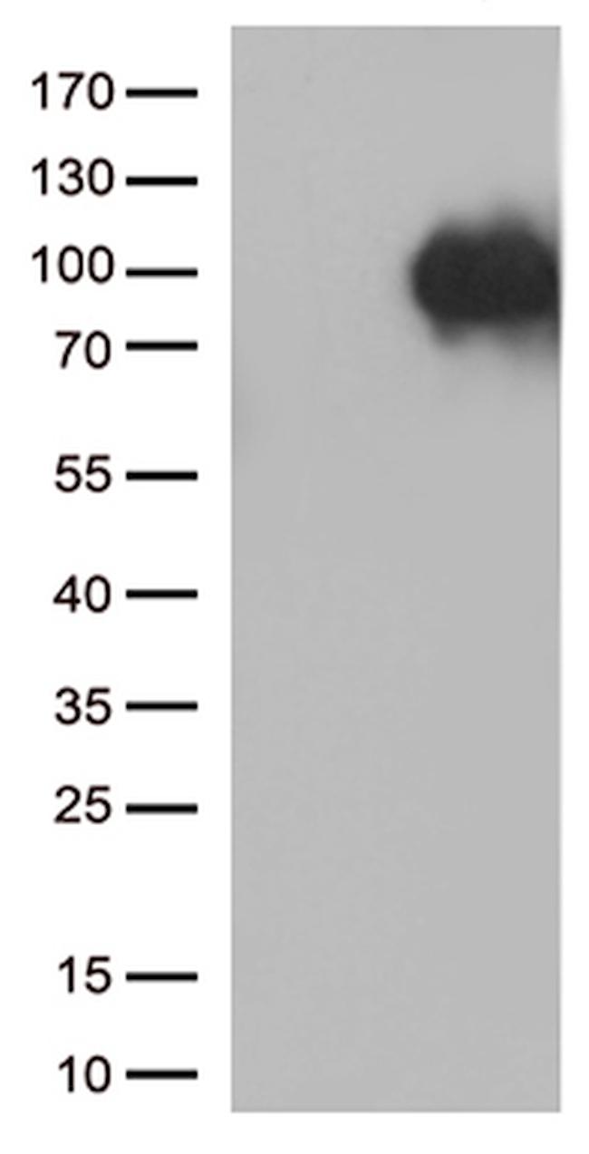 SORT1 Antibody in Western Blot (WB)
