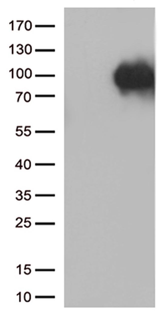 SORT1 Antibody in Western Blot (WB)