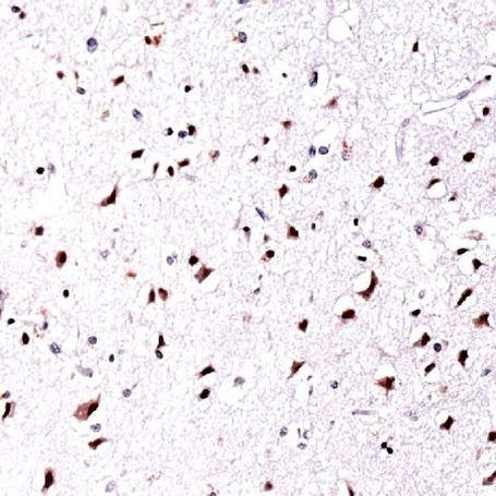 SOX4 Antibody in Immunohistochemistry (IHC)