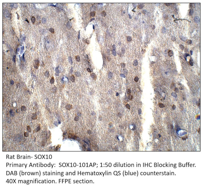 SOX10 Antibody in Immunohistochemistry (IHC)