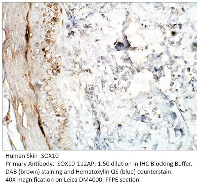 SOX10 Antibody in Immunohistochemistry (IHC)