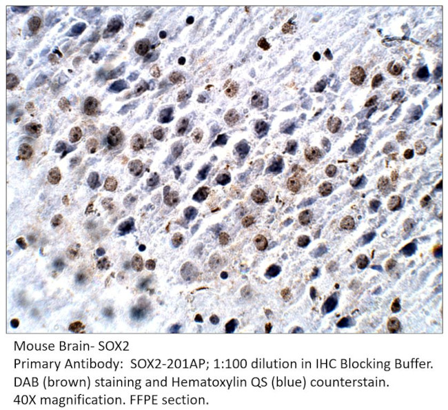SOX2 Antibody in Immunohistochemistry (IHC)