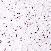 SOX4 Antibody in Immunohistochemistry (IHC)