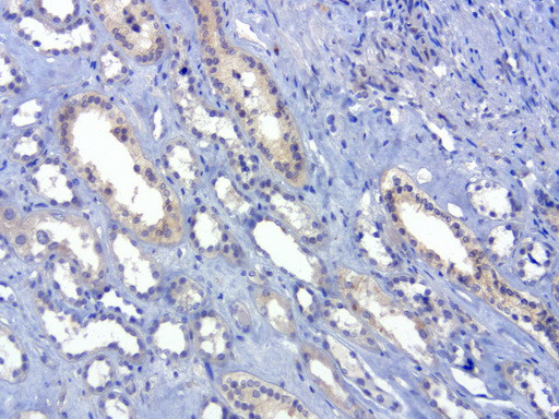 SOX5 Antibody in Immunohistochemistry (Paraffin) (IHC (P))