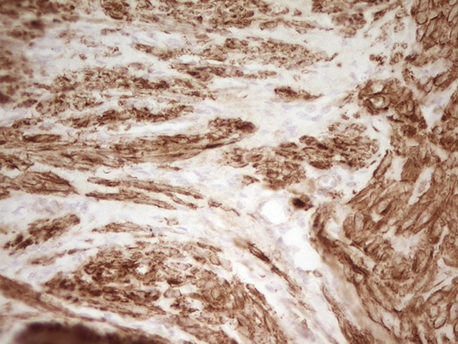 SP110 Antibody in Immunohistochemistry (Paraffin) (IHC (P))