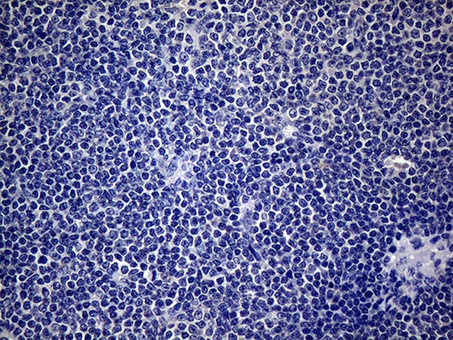 SP110 Antibody in Immunohistochemistry (Paraffin) (IHC (P))