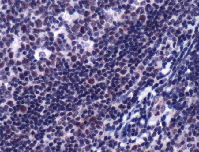 SP1 Antibody in Immunohistochemistry (IHC)