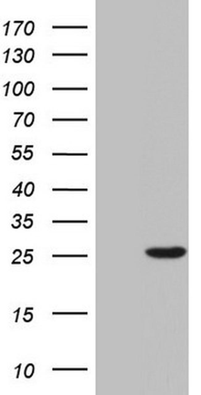 SPA17 Antibody in Western Blot (WB)