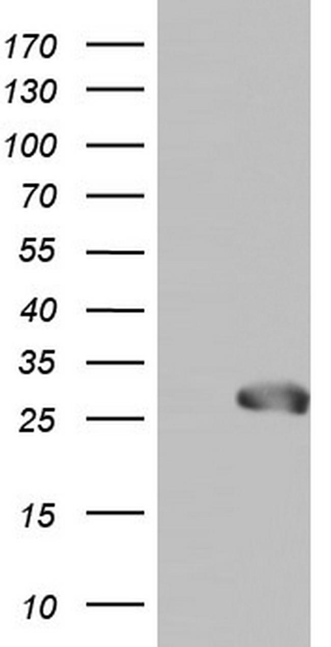 SPA17 Antibody in Western Blot (WB)