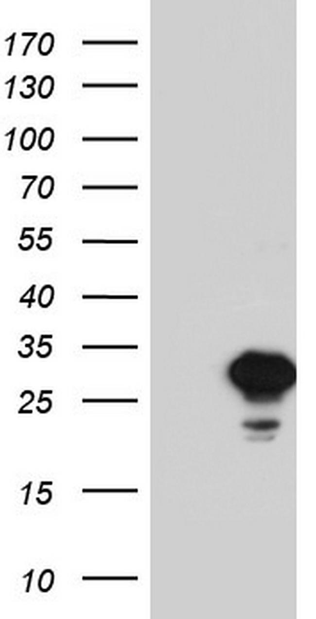 SPA17 Antibody in Western Blot (WB)