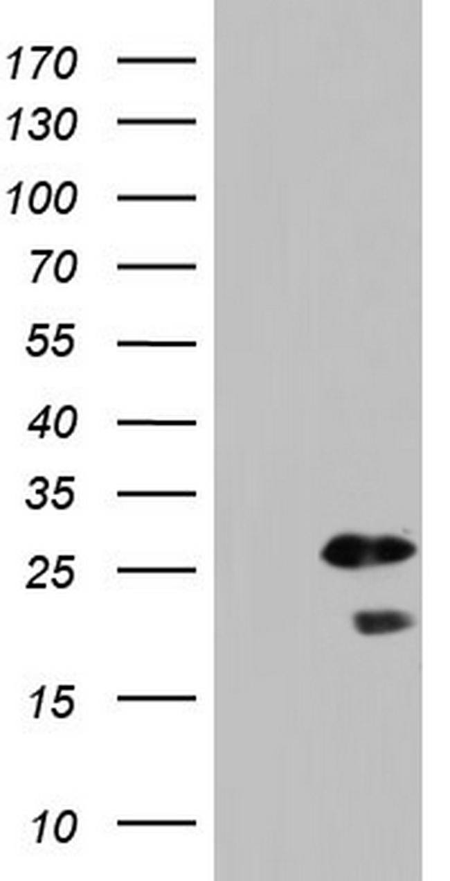 SPA17 Antibody in Western Blot (WB)