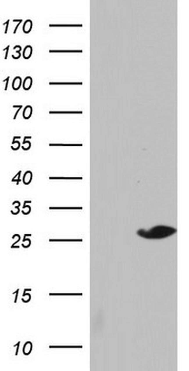 SPA17 Antibody in Western Blot (WB)