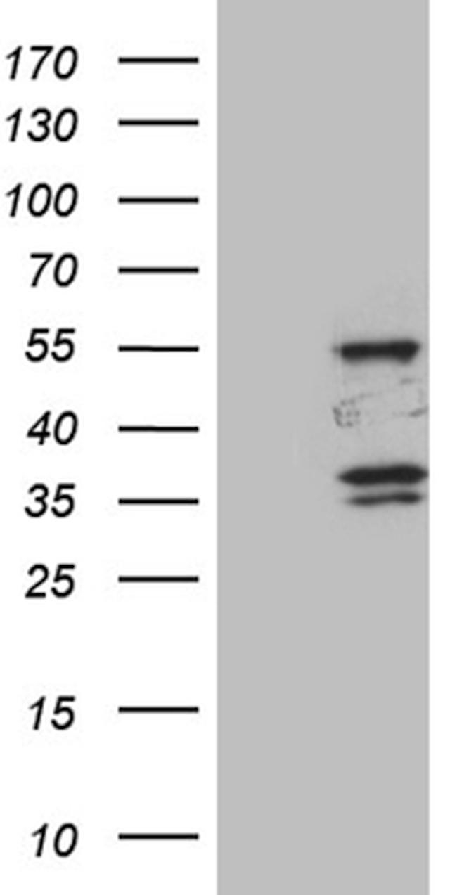 SPAG4 Antibody in Western Blot (WB)