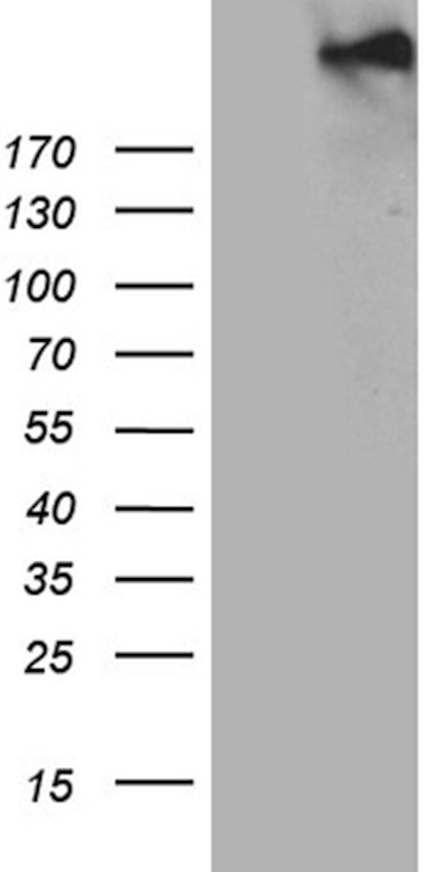 SPAG5 Antibody in Western Blot (WB)