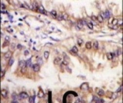 STK39 Antibody in Immunohistochemistry (IHC)