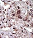 STK39 Antibody in Immunohistochemistry (IHC)