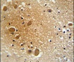 SPARCL1 Antibody in Immunohistochemistry (IHC)